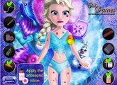 Permainan terluka elsa beku - Play elsa injured frozen Games