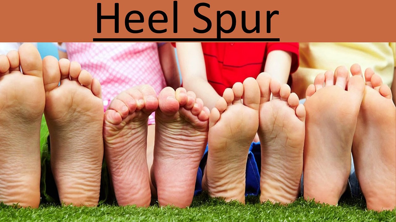 Heel spur