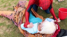 Frozen Elsa Loses Her Nose! w/ Spiderman, Frozen Anna & Joker - Funny Superhero Video
