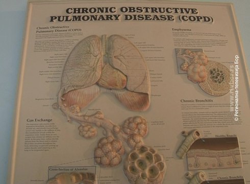 Dan borbe protiv HOBP-a, 15. novembar 2016. (RTV Bor)