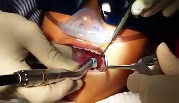 Biolase Laser Dentisty - Phan-tastic Smiles