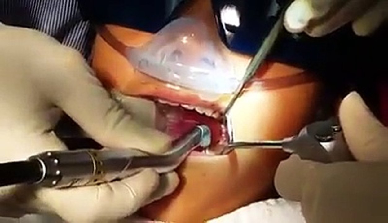 Biolase Laser Dentisty - Phan-tastic Smiles