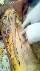 thigh flexor muscles PGIMS Rohtak