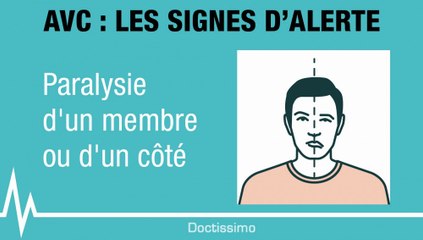 AVC : les signes qui doivent vous alerter