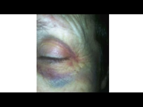 Arezzo - Disabile picchiata dai suoi badanti: arrestata coppia cingalese (16.11.16)