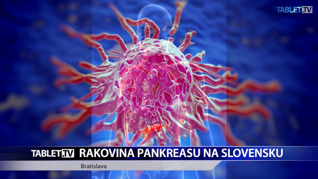 Rakovinu pankreasu nájdu lekári často neskoro, väčšina pacientov umiera