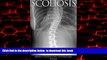 liberty book  Scoliosis: A Guide to Understanding and Overcoming Scoliosis (scoliosis, low back