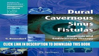 Read Now Dural Cavernous Sinus Fistulas: Diagnosis and Endovascular Therapy (Medical Radiology)