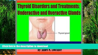 Read book  Thyroid Disorders and Treatments: Underactive and Overactive Glands online pdf