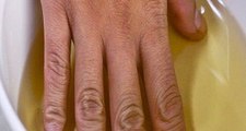 She Put Her Hands in Apple Cider Vinegar Twice a Week. You Will Not Believe What Effect is Achieved!