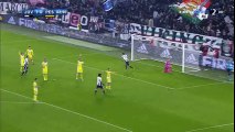 Mario Mandzukic Goal HD - Juventus 2-0 Pescara  - 19.11.2016 HD