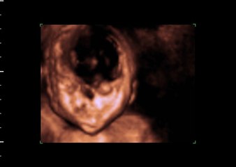 VIDEO DE PETER Y JOSELYN 4