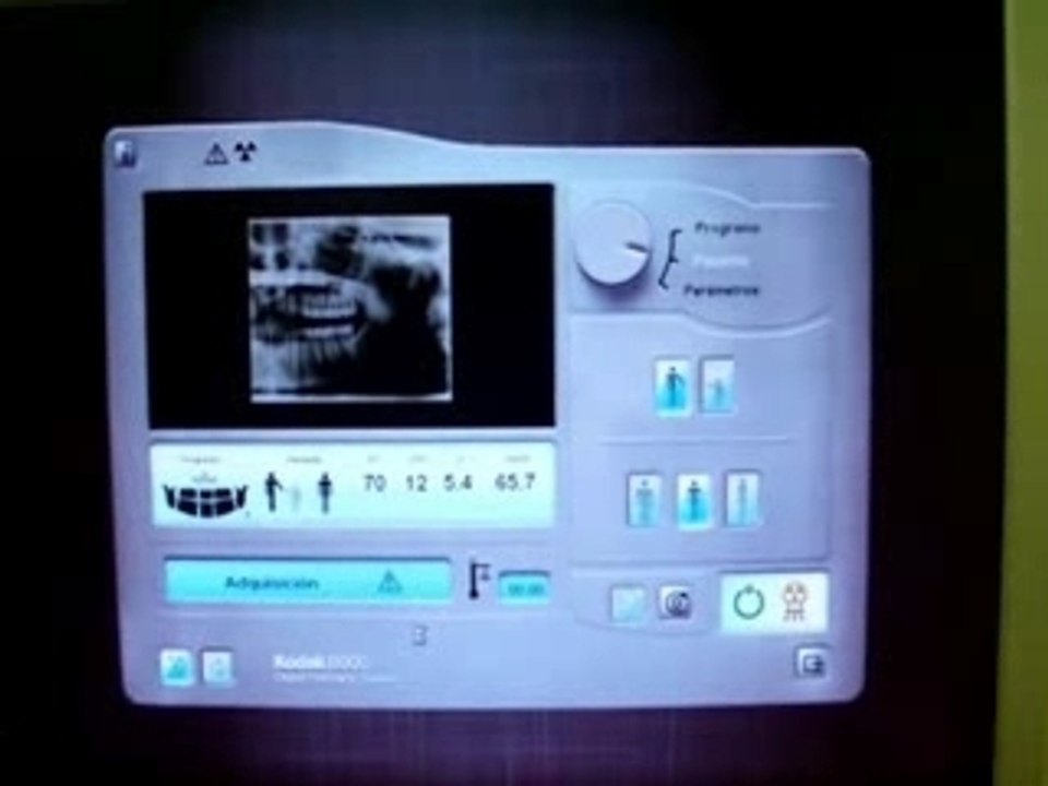 Radiografia