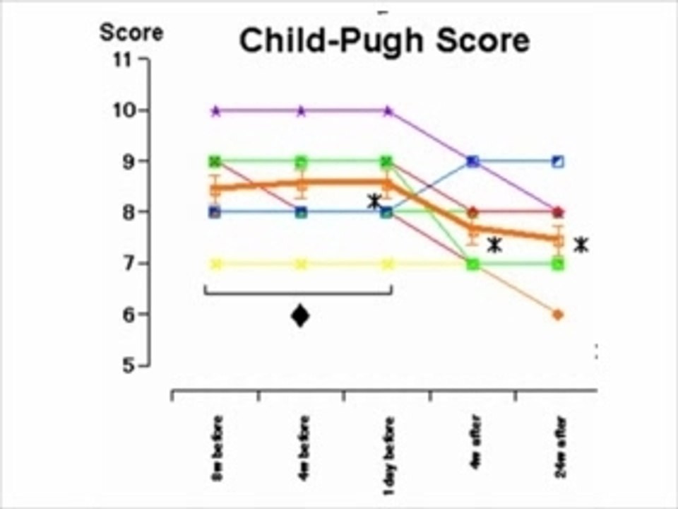 Stem Cell Therapy for Liver Failure