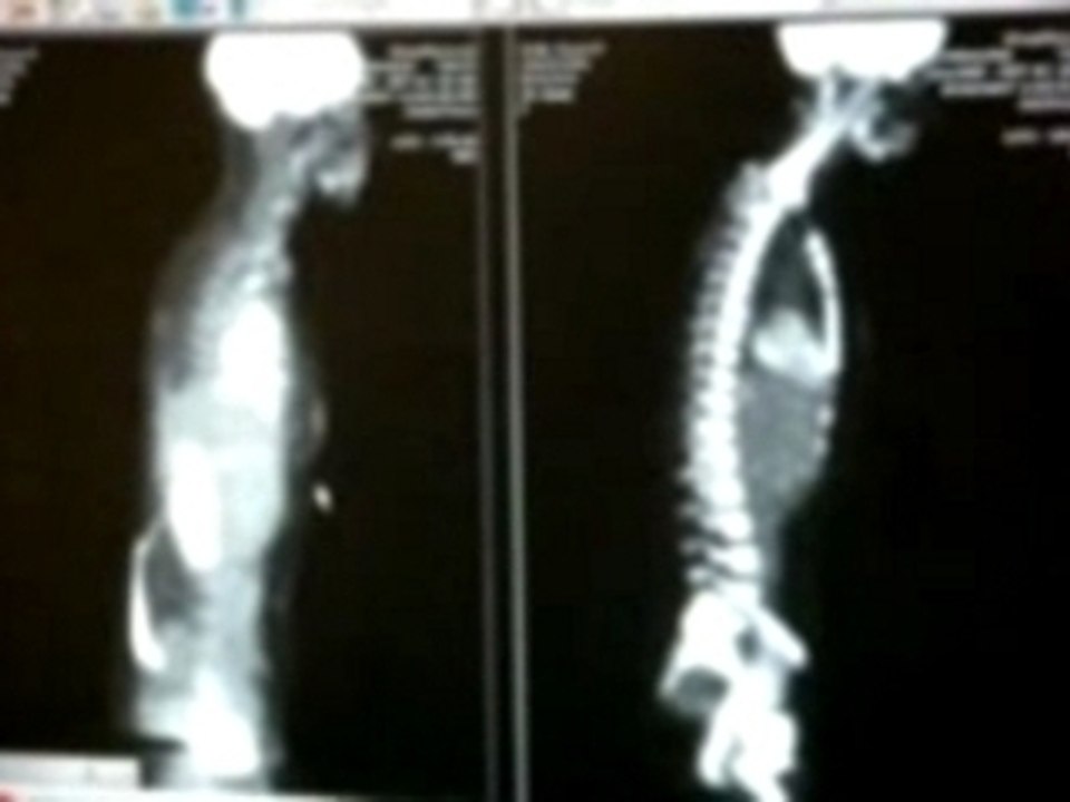 PET scan comparison