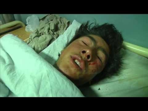 Afganistan, sulm vetëvrasës në xhaminë e Kabulit, 27 viktima - Top Channel Albania - News - Lajme