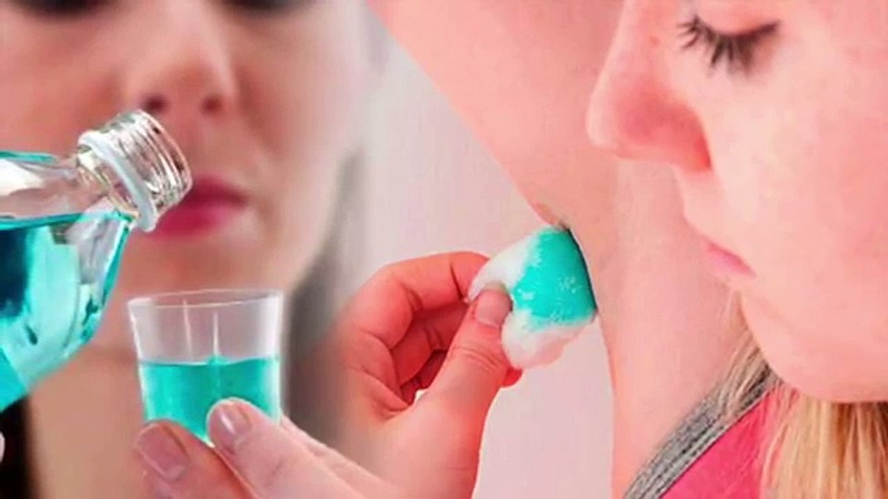 28. She wets a cotton in Listerine and uses it in her armpit. Look what happens minutes later. Amazing