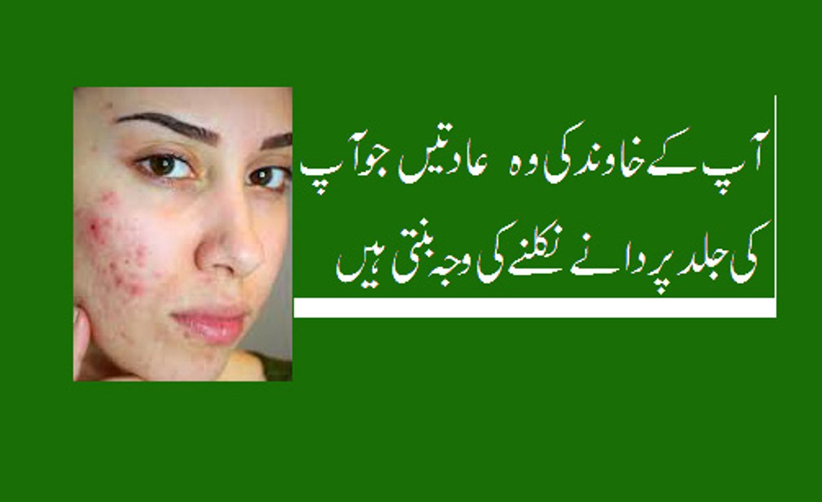 Husband Ki Ghalti Ki Waja Sy Wife K Face Per Dane Nikal Aate Hain چہرے پر پنھسی کی وجہ  آپ کا شوہر