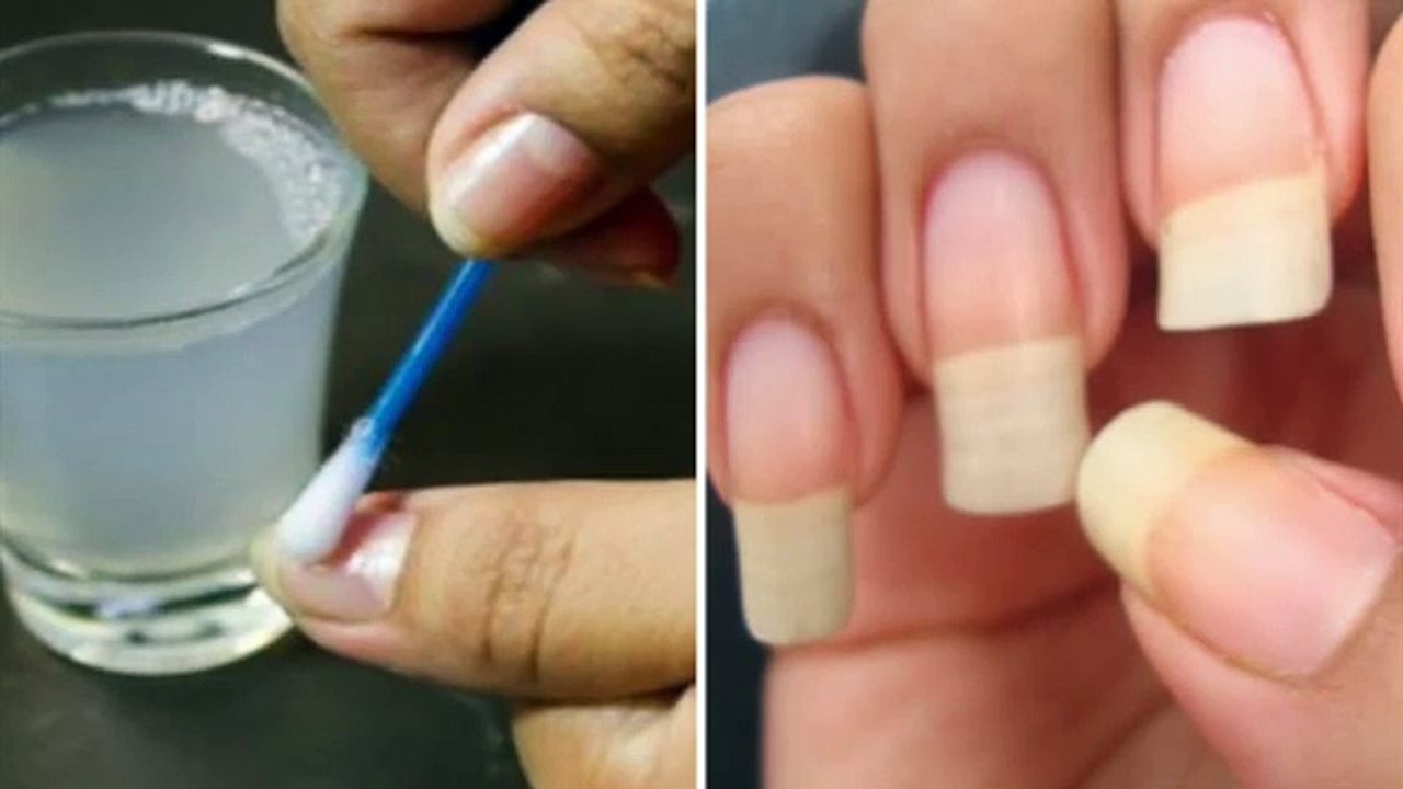 64. She did this and her nails grew quickly. It was told by a friend who is a dermatologist