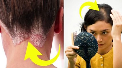 63. If this happens to you, you have stress. GREAT CARE