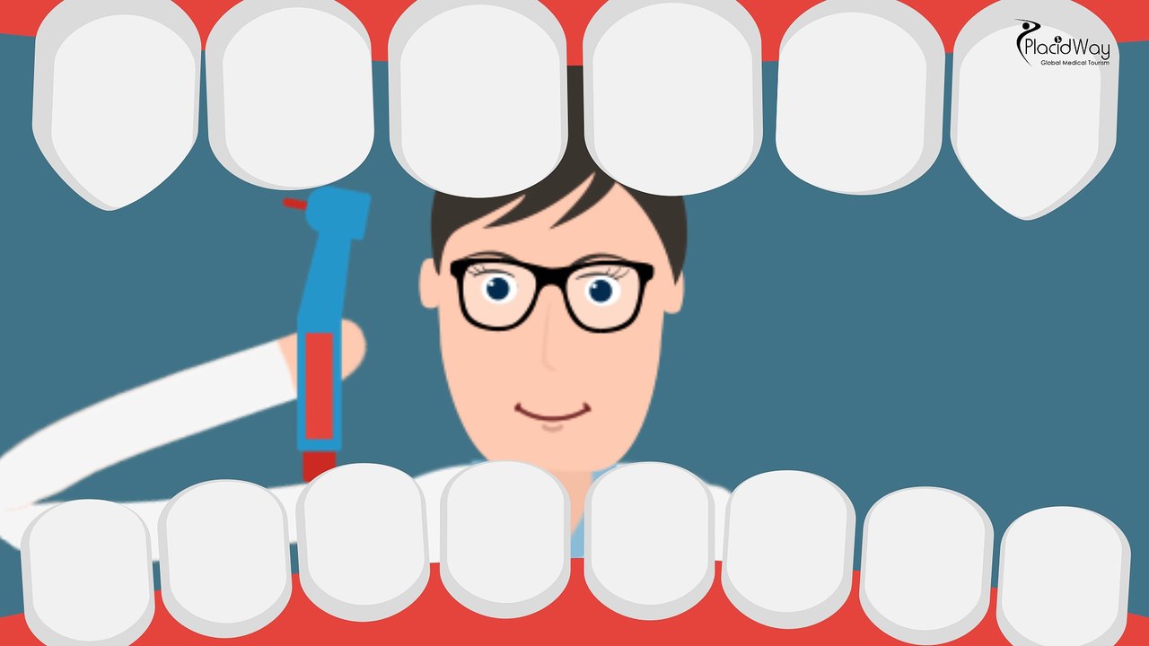 All On 4 Dental Implants and Cosmetic Dentistry in Mexico