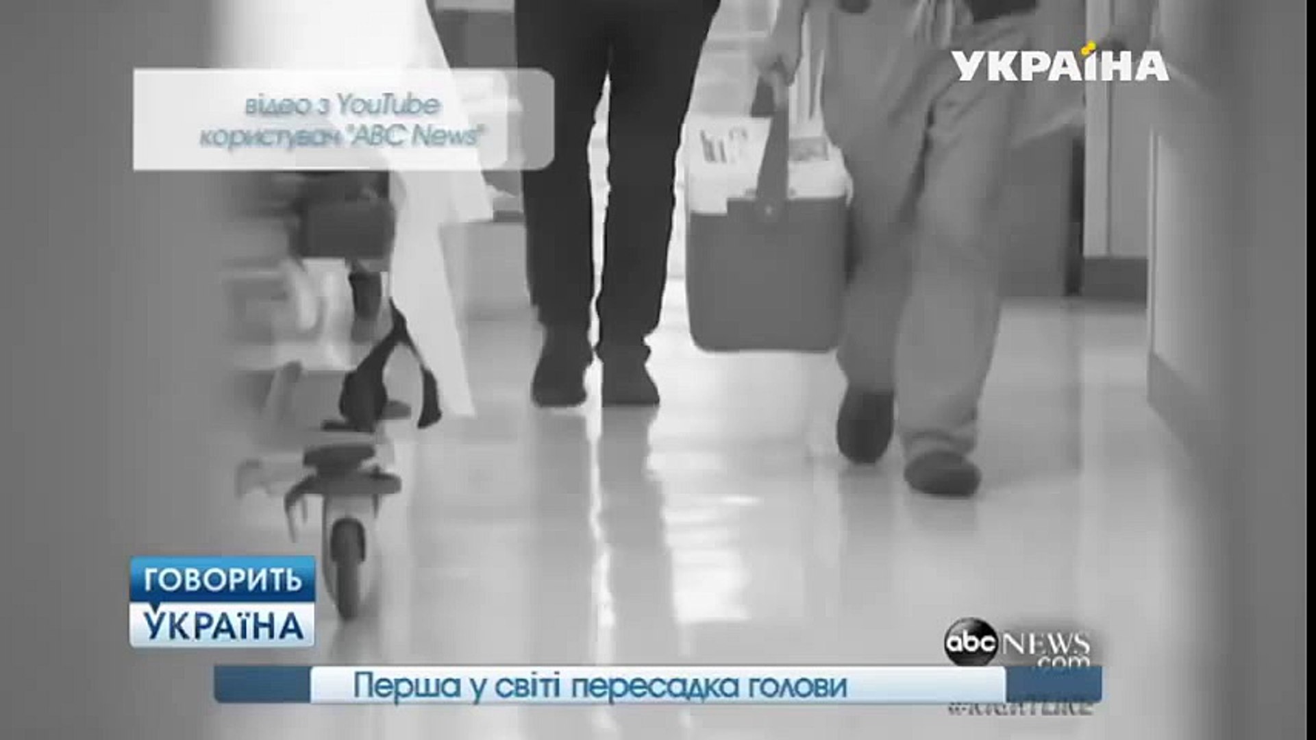 Первые попытки пересадки сердца человеку | Говорить Україна