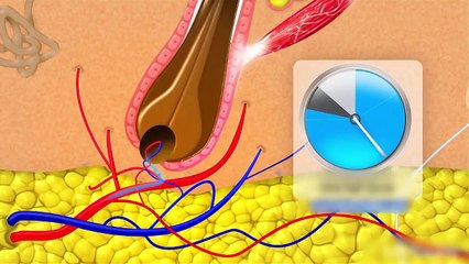 Truyền chất dinh dưỡng nuôi dưỡng tránh rụng tóc