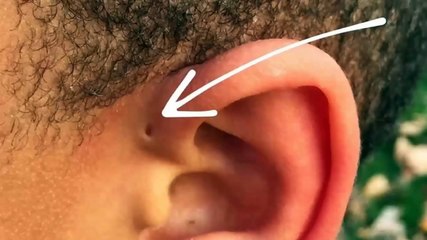 Kuch Logoun K Kaan Per Surakh Q Hote Hain