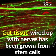 Tejido intestinal cultivado en laboratorio