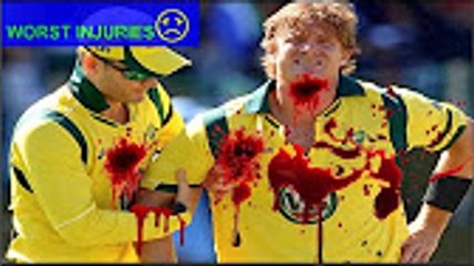 Top 5 - Worst Injury - Death In Cricket Field Ever That Will Make You Cry (⌣̩̩́_⌣̩̩̀)