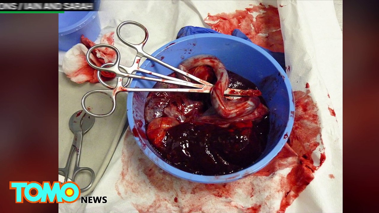 How scientists can harvest stem cells from human teeth