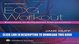 MOBI DOWNLOAD ECG Workout: Exercises in Arrhythmia Interpretation PDF Kindle