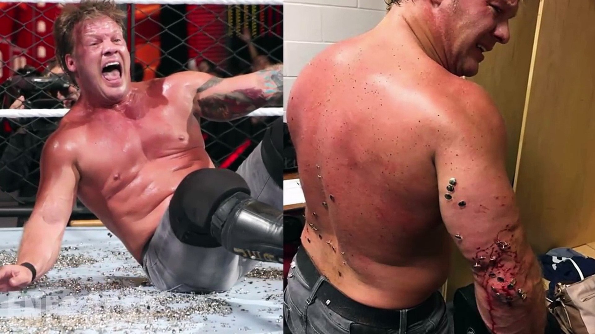 Top 10 Worst Injuries in WWE - video 