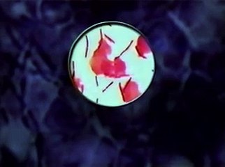 Anthrax Disease Basic Information 2002 USEPA