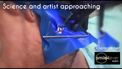 Dental Work in Tijuana Mexico