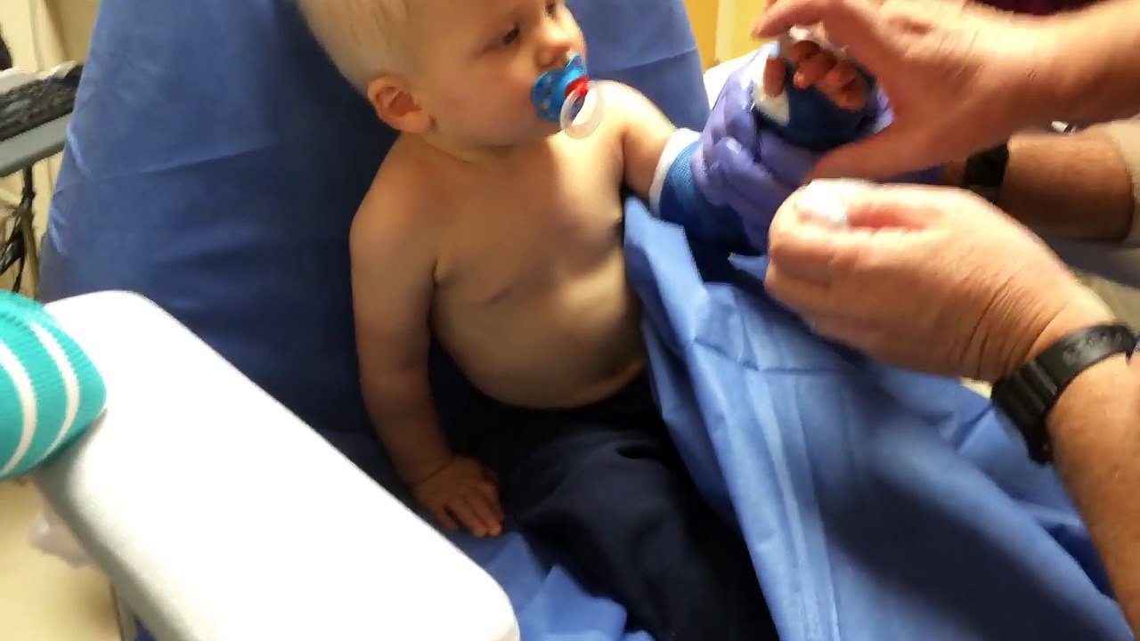 Update: Baby Michael Gets His First Cast