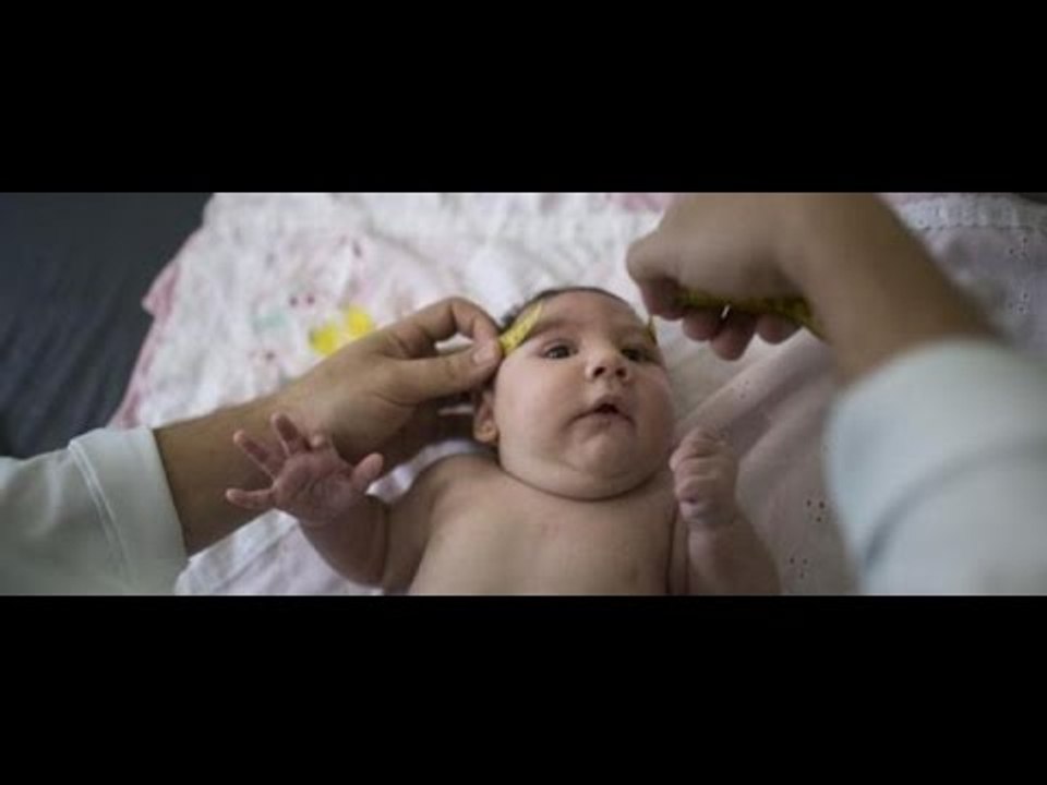 Zika Virus A plague in South America and Africa