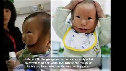 Les médecins ne l'autorisaient pas à voir son bébé, mais quand elle l'a vu, elle s'est évanouie