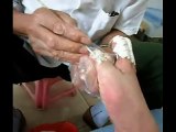 Professional Foot Care (24) Treatment of Foot Diseases and Nail Fungus
