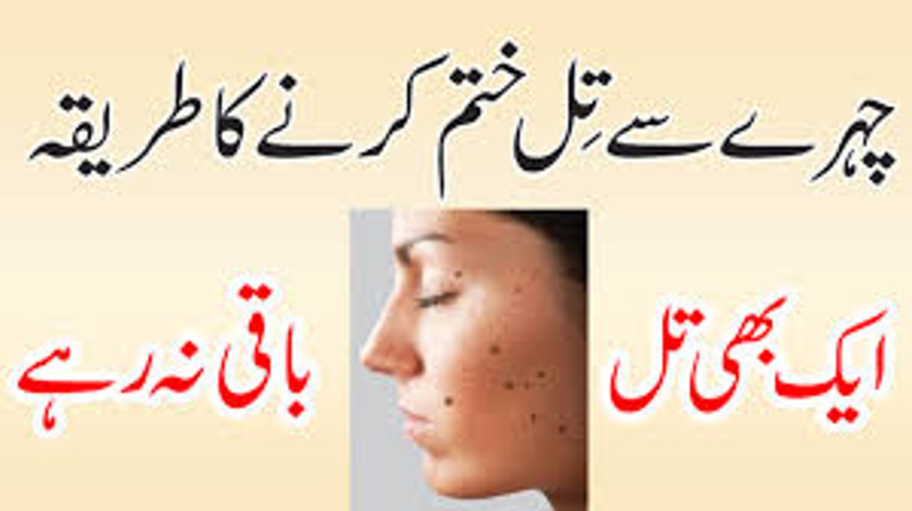 Blackhead Khatam Karne Ka Asan Gharelu Ilaj  How to Remove Blackheads From Nose & Face