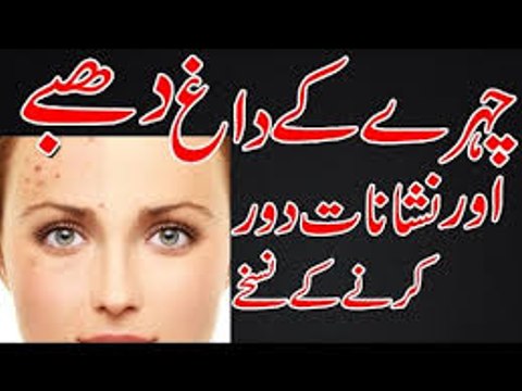 Chehre Ke Gadde Aur Daag Dhabe Door Karne Ka Asan Gharelu Ilaj Removing Acne Scars