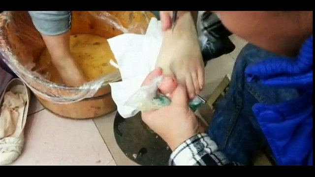 Professional Foot Care (50) Relaxing Nail Pedicure and Treatment of Nail Fungus