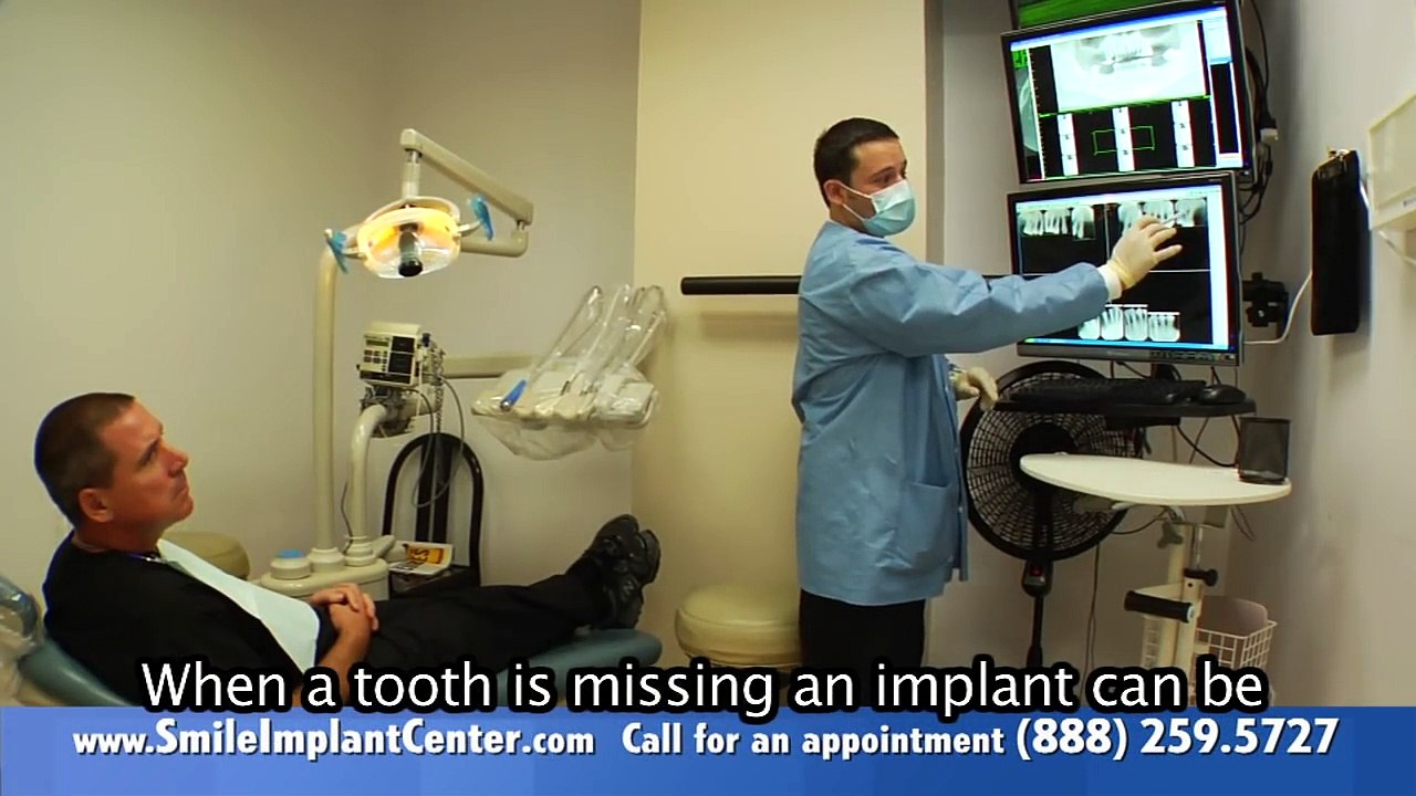 A Single Implant - Why replace missing teeth