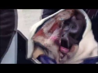 Dilencinin Kucağındaki Bebek Sahte Çıktı