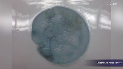 Breast Implant in Police 'Murder' Probe Turns Out To Be a Jellyfish