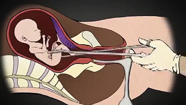 kürtaj-cinayettir-paylaş-herkes-gorsun-