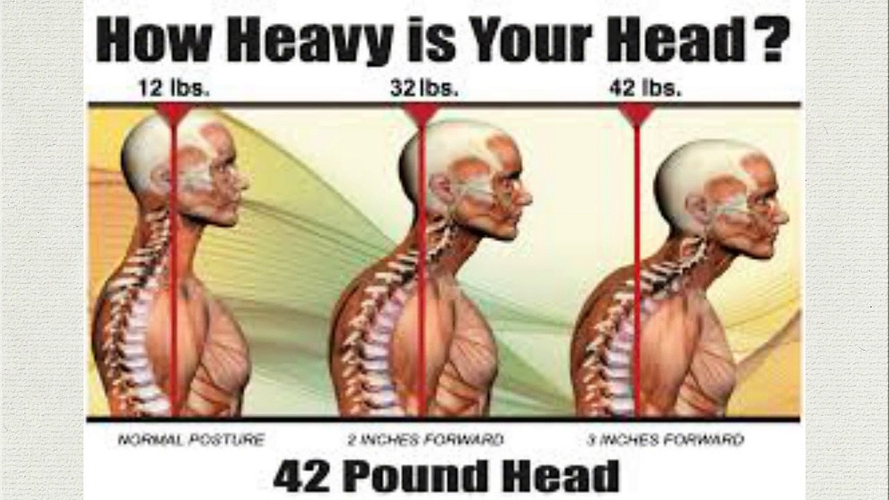 Text Neck Stamford CT Daily Motion