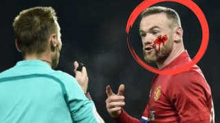Wayne Rooney blood face (injury) vs West Ham 30/11/2016