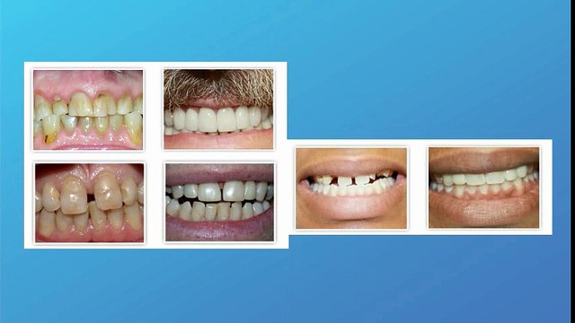 cosmetic dentistry north york