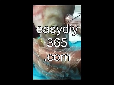 Professional Foot Care (67) Relaxing Treatment of Foot Diseases and Plantar Warts